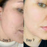 face glow before after
